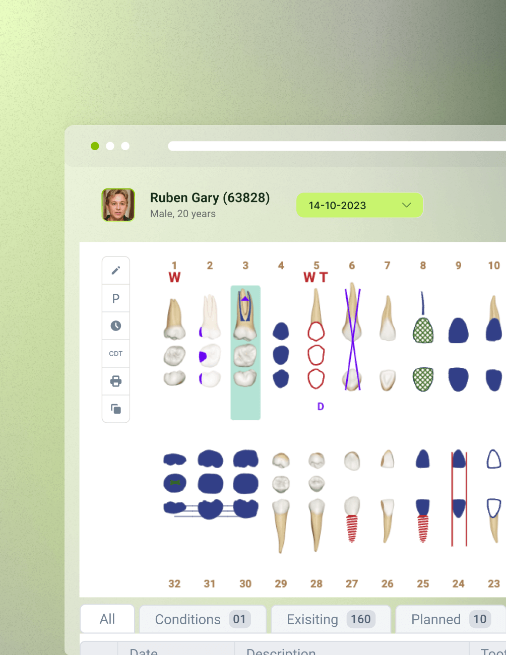 Dental chart interface showing various tooth diagrams, annotations, and a patient profile with the name "Ruben Gary," dated 14-10-2023.