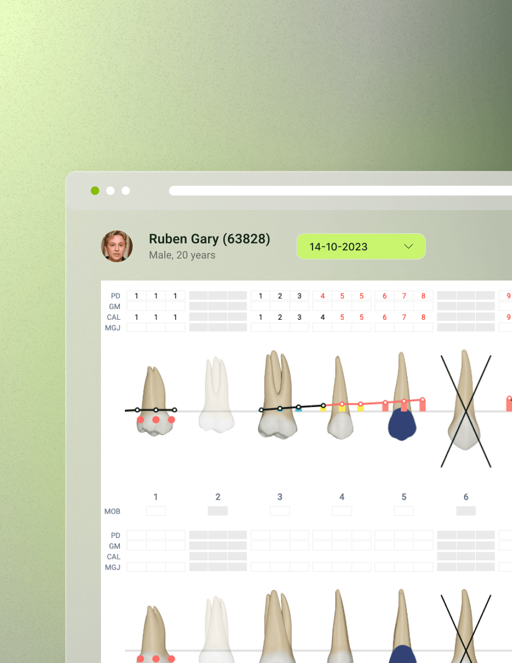 Dental chart on a computer screen showing various tooth diagrams with annotations and a patient profile named Ruben Gary.